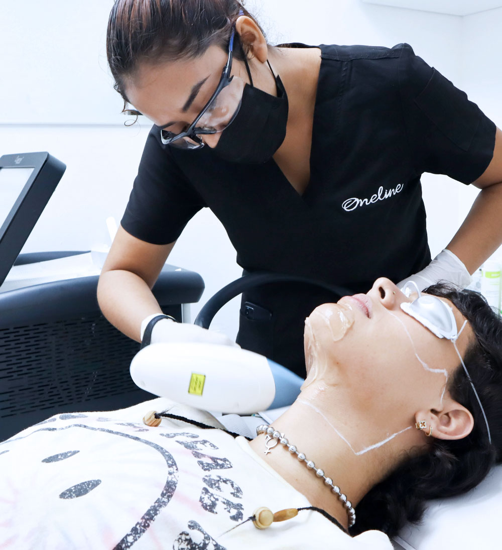 Depilación láser - láser de diodo