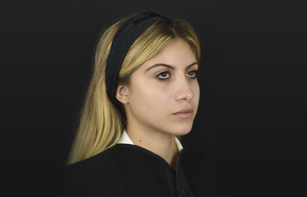 Tratamiento aumento de labios