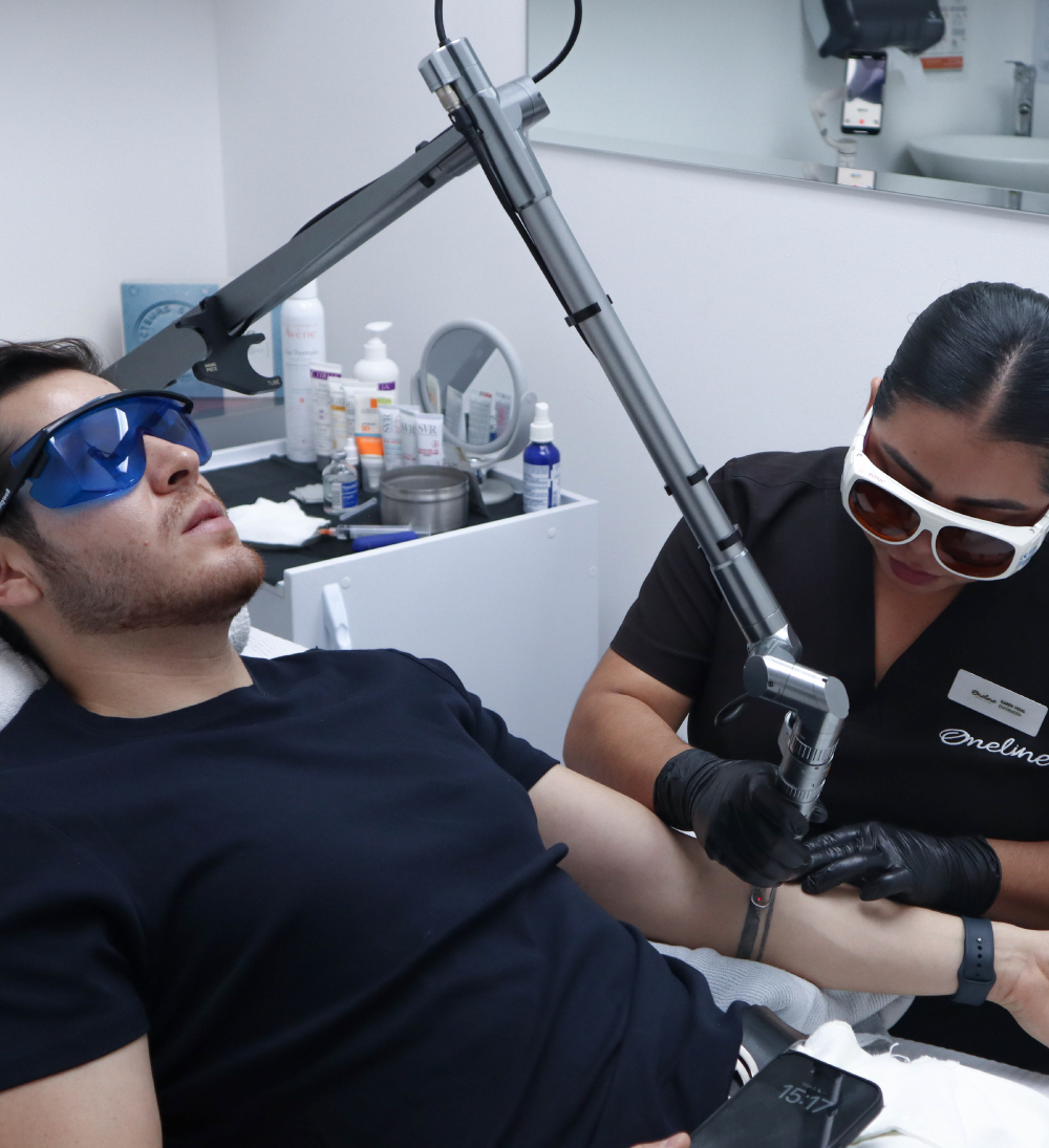 Eliminación de tatuajes - tratamiento láser