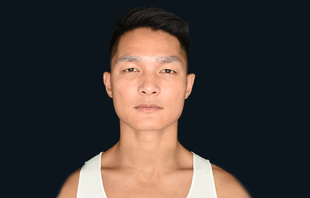 Tratamiento Hidroxiapatita de Calcio