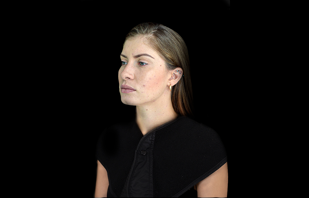 Tratamiento Juvederm