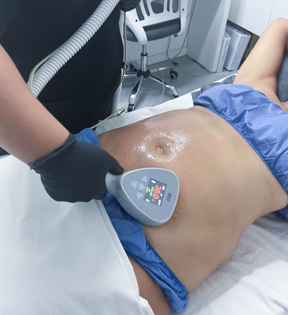 Aparatología reductiva BTL X Wave